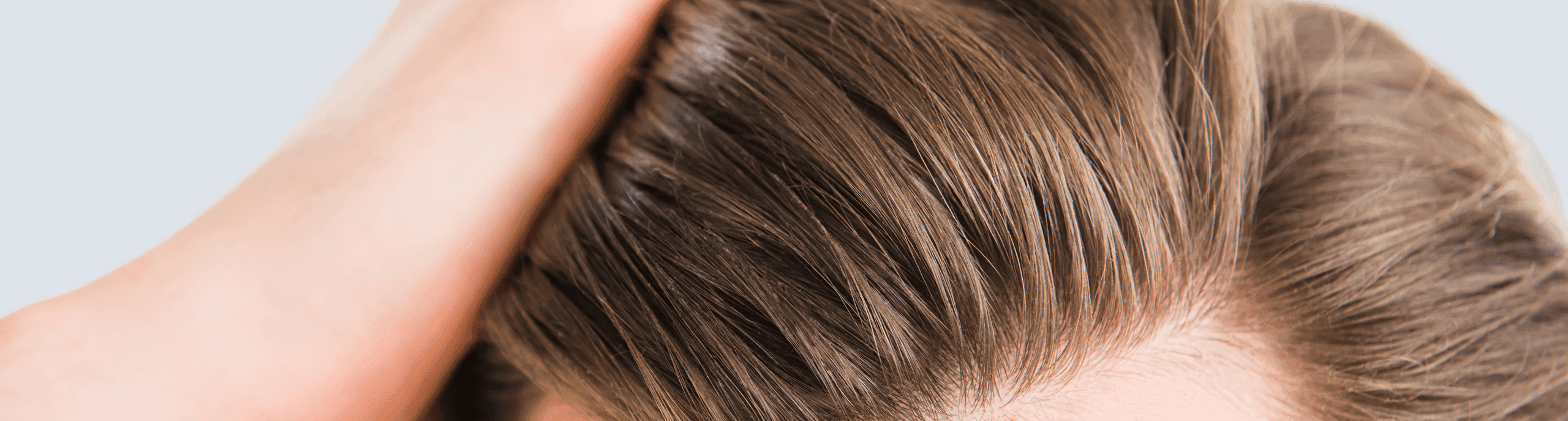 A person's hair showing signs of baldness