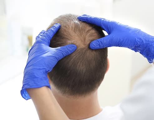 A doctor examining a patient's scalp